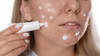 acne medicine on pimples
