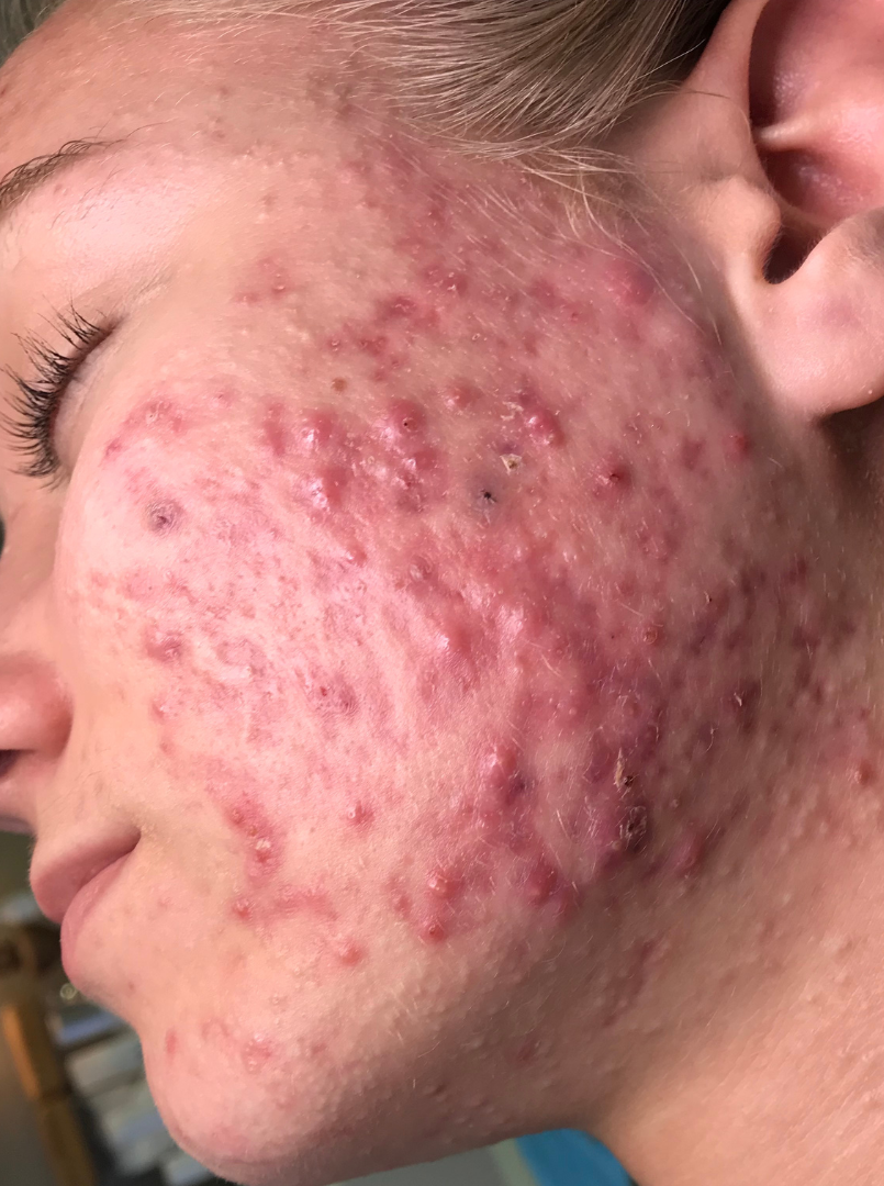 Before and After